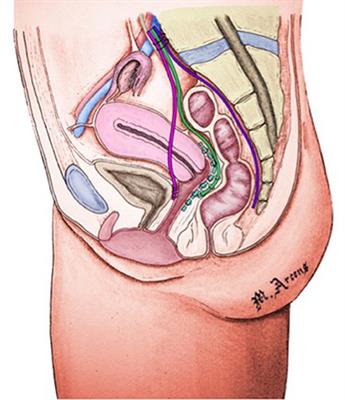 Descending Perineum Associated With Pelvic Organ Prolapse Treated by Sacral Colpoperineopexy and Retrorectal Mesh Fixation: Preliminary Results